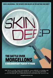 دانلود مستند Skin Deep: The Battle Over Morgellons 2019104233-1939526832